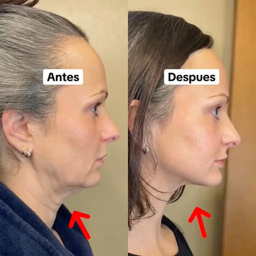 Collagen Face Sculpt Wrap - Esculpe tu belleza